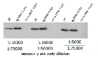 Rnr1 | Ribonucleoside-diphosphate reductase large subunit in the group Antibodies, Bacterial/Fungal at Agrisera AB (Antibodies for research) (AS16 3639)